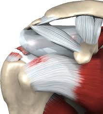 Rotator cuff tendonitis