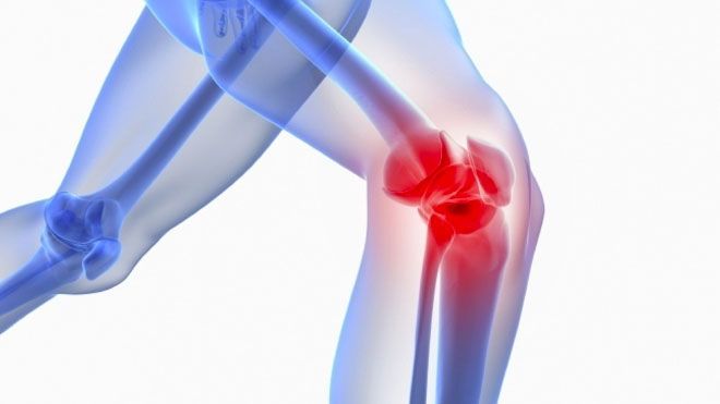 Knee Pain Symptoms